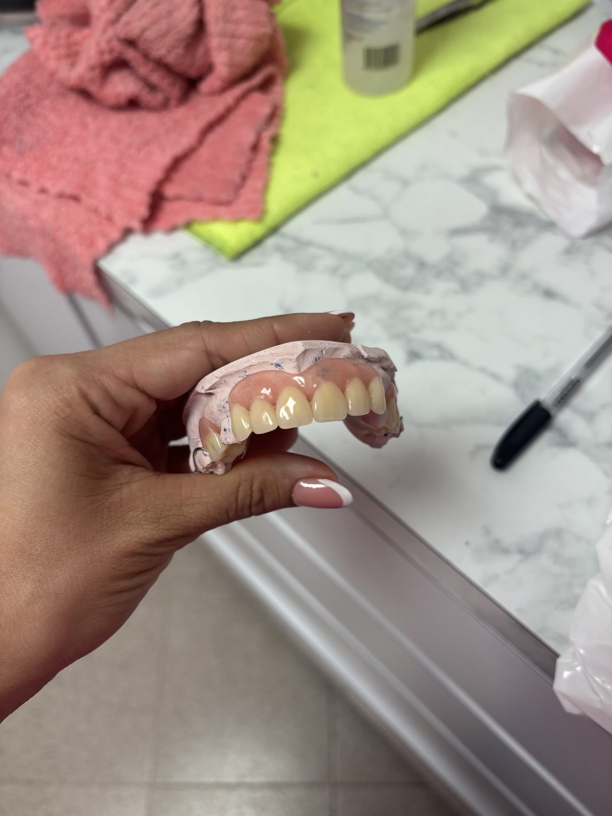Prótesis dental superior sobre su modelo de yeso, sostenida en la mano